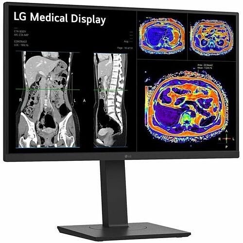 Lg 27HS713C-B Monitors Lg 27hs713c-b 27" Class Webcam 4k Uhd Led Monitor - 16:9 - Black - 27" Viewable - In-plane Switching 27hs713cb 195174113875